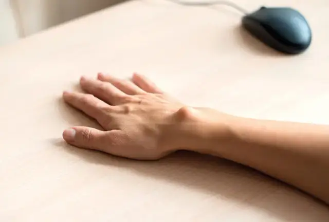 Ganglion do jakiego lekarza? Odpowiedni specjalista na wagę zdrowia