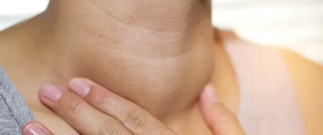 Pierwsze objawy wola tarczycy – jak je rozpoznać i co oznaczają