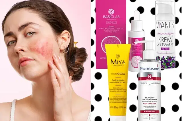 Peeling do cery naczynkowej: bezpieczne złuszczanie i wzmocnienie skóry