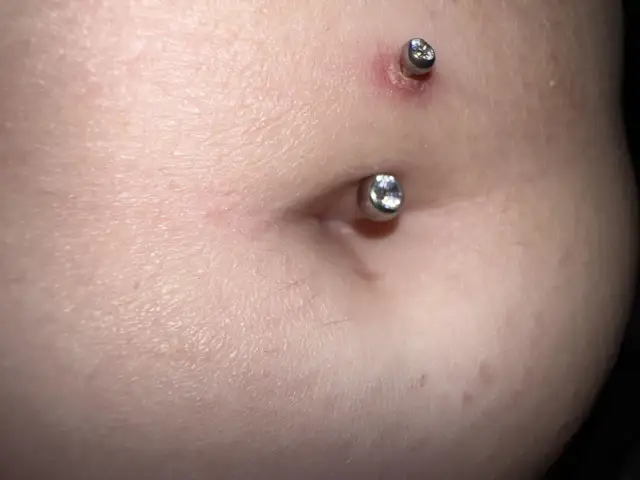 Ile czasu goi się kolczyk w pępku? Poznaj czynniki wpływające na czas gojenia