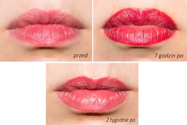 Jak myć zęby po makijażu permanentnym ust, by nie zniszczyć efektu