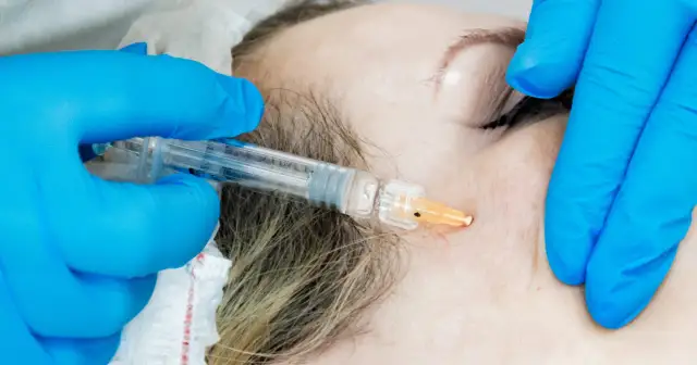 Kosmetolog a lekarz: Uprawnienia po 2026. Jak wybrać bezpiecznie?