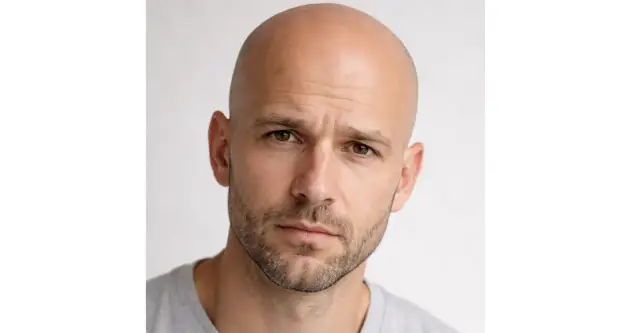 Przeszczep włosów – jak wygląda procedura od strony medycznej i biologicznej?