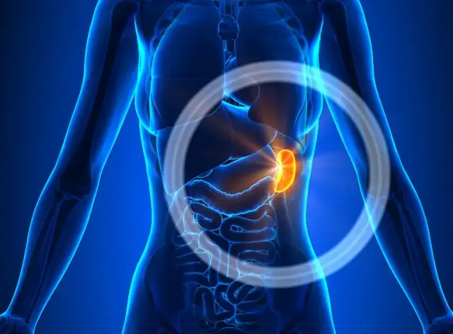 Ból śledziony objawy: Jak rozpoznać i co może oznaczać?