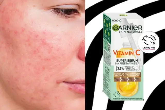 Co daje serum z witaminą C? Rozjaśnij przebarwienia, ujędrnij skórę!