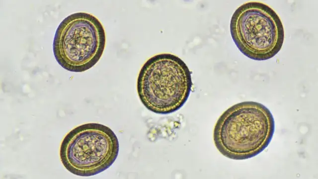 Czy podczas odrobaczania dziecko może chodzić do przedszkola? Ważne informacje