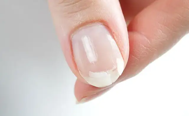 Cienkie paznokcie jak papier: przyczyny i skuteczne sposoby wzmocnienia