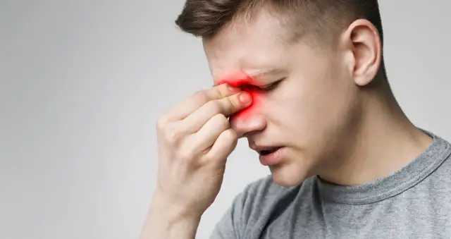 Mężczyzna z bólem zatok, czerwone podświetlenie na nosie i czole. Może to być objaw kataru z krwią.