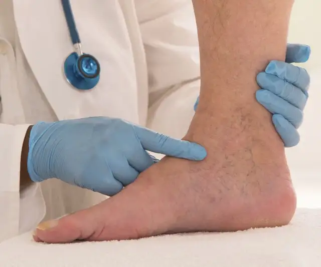 Chirurg naczyniowy: Kiedy szukać pomocy i co leczy? Poradnik