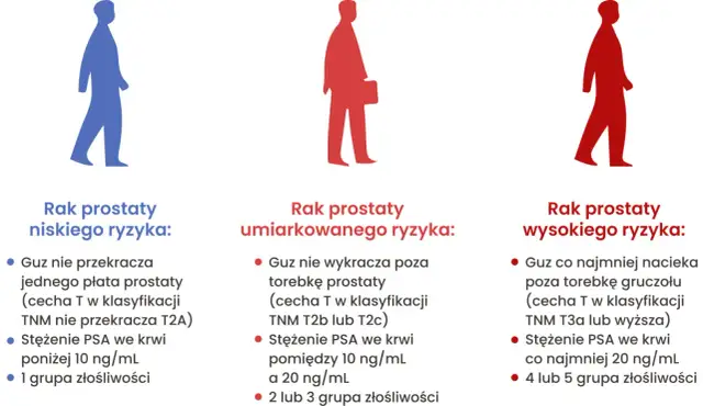 Badanie prostaty: na czym polega? Rozwiewamy mity i obawy