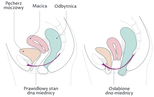 Jakie ćwiczenia na odbyt pomogą wzmocnić mięśnie i poprawić zdrowie