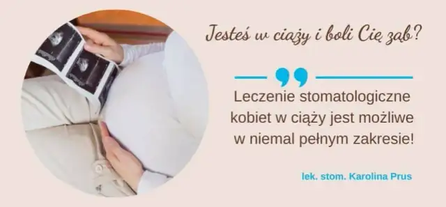 Bezpieczne znieczulenie stomatologiczne w ciąży: Poradnik dla mam