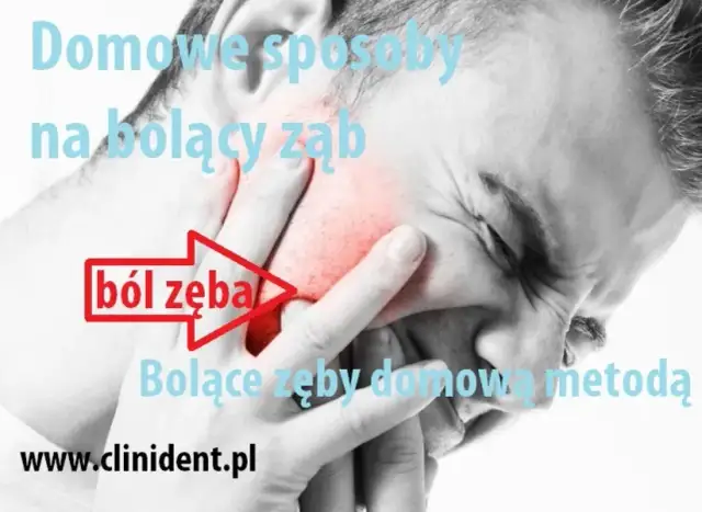 Pulsujący ból zęba: co robić? Domowe sposoby i kiedy do dentysty