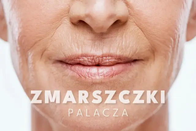 Zmarszczki na policzkach - Jak je rozpoznać i skutecznie wygładzić?