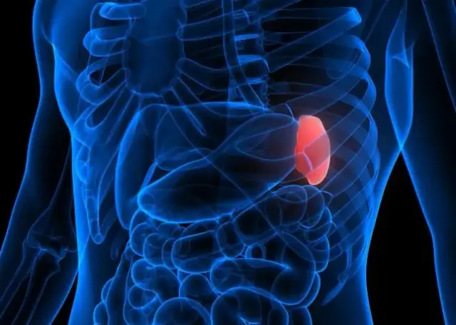 Nowotwór śledziony objawy: jak je rozpoznać i kiedy szukać pomocy