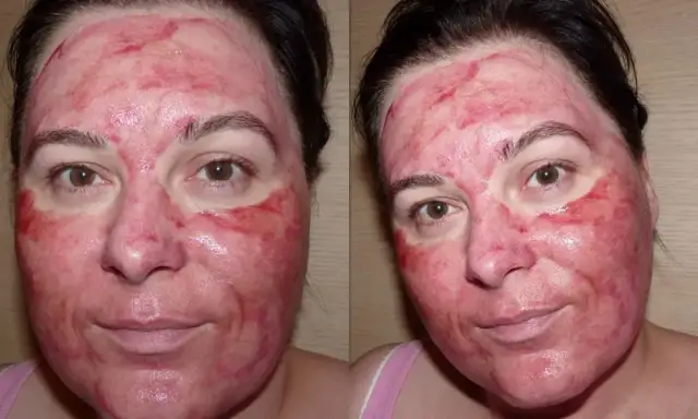 Jak bezpiecznie używać krwawego peelingu The Ordinary dla najlepszych efektów