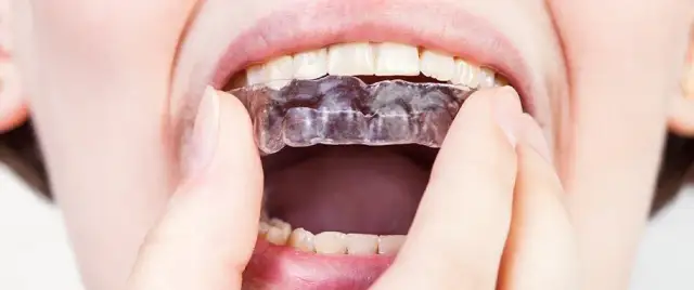 Jakie leki na bruksizm skutecznie łagodzą objawy i bóle?