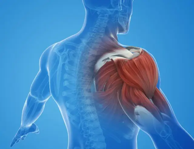 Contractura muscular: Identifica el "nudo" y dile adiós al dolor.