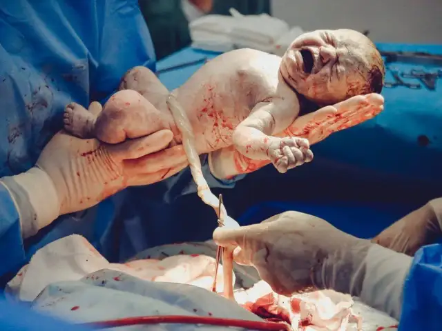 Nowe życie, pierwsza doba po cesarce. Dziecko trzymane przez dłonie w rękawiczkach, z pępowiną.