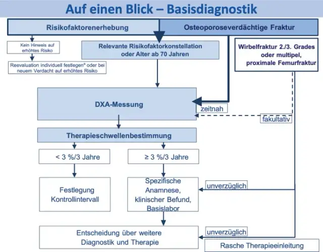 Die entscheidenden Schritte zur Osteoporose Diagnostik verstehen