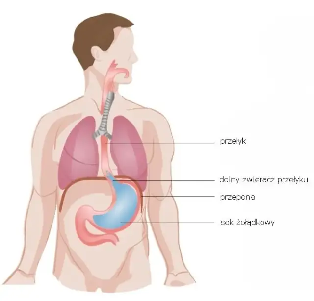 Nerwica przełyku objawy: Jak rozpoznać niepokojące symptomy?