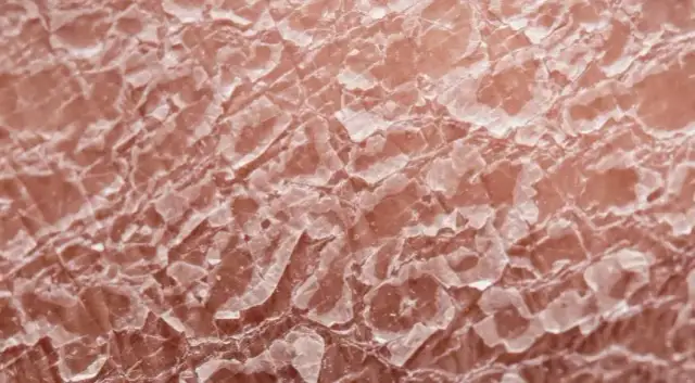 Jakie kosmetyki w czasie chemioterapii pomogą chronić wrażliwą skórę?