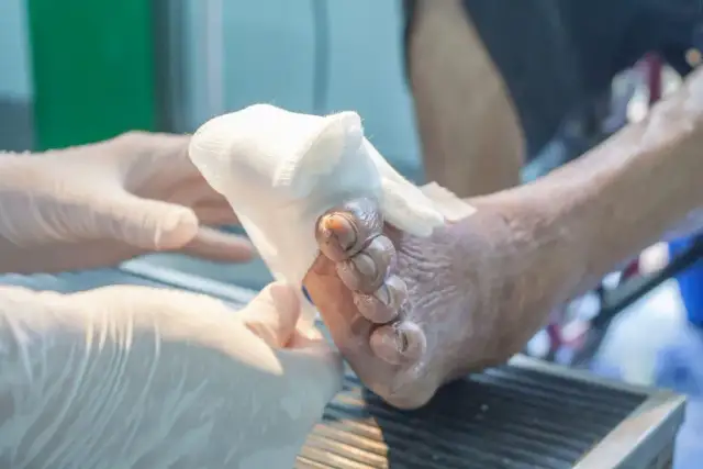 Skuteczne metody na ból neuropatyczny, które przynoszą ulgę