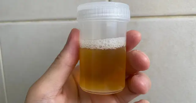 Mocz niemowlaka: Ile ml i jak pobrać bez stresu? Poradnik