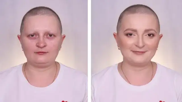 Czy po chemii wypadają brwi i rzęsy? Poznaj prawdę o skutkach terapii