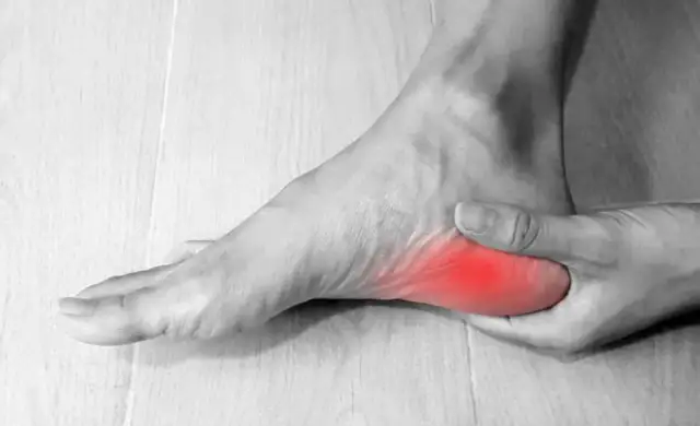 Ból pięty: poznaj przyczyny i skutki, które mogą cię zaskoczyć