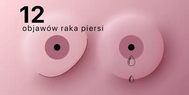 Jak rozpoznać raka piersi? Objawy, samobadanie i wczesne wykrycie choroby
