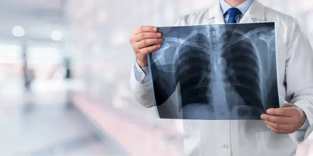 Objawy nowotworu płuc – nie bagatelizuj tych niepokojących sygnałów