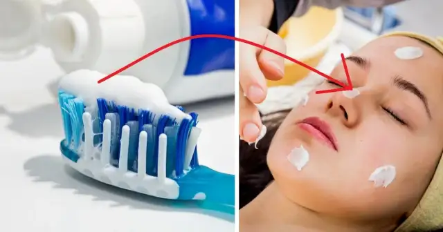 Czy pasta do zębów wysusza pryszcze? Prawda i ryzyko dla skóry