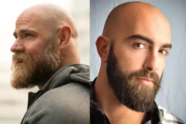 Fryzura na łyso: Pasuje? Odkryj zalety i wady, zanim ogolisz!