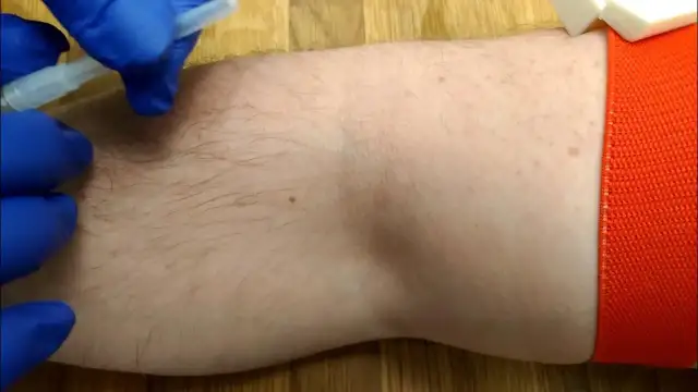 Jak podłączyć kroplówkę – bezpieczna instrukcja krok po kroku z ostrzeżeniami