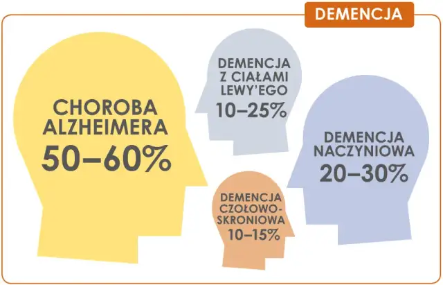 Otępienie: choroba mózgu czy umysłu? Poznaj medyczną klasyfikację