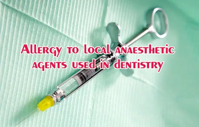 Objawy uczulenia na znieczulenie u dentysty – jak rozpoznać i zapobiec reakcji alergicznej