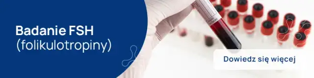 Jaki wynik FSH świadczy o menopauzie i co to oznacza dla zdrowia?
