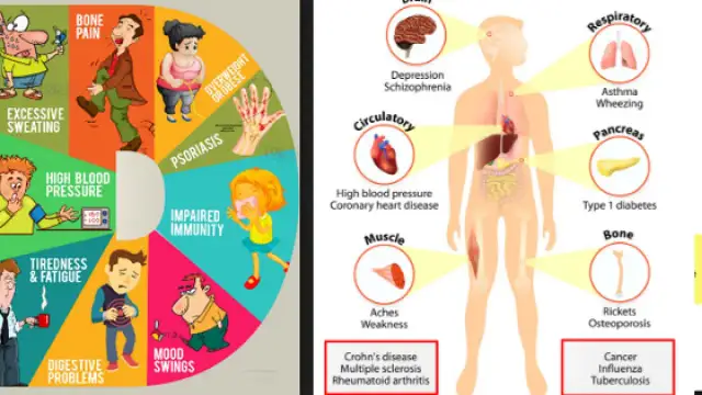 Niedobór witaminy D: objawy, które ignorujesz. Rozpoznaj i działaj!