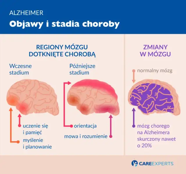 Choroby neurodegeneracyjne: Objawy, które musisz znać.