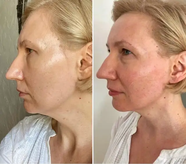 Jak często masaż Kobido? Fazy, efekty i Twój plan