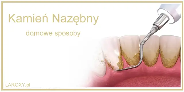 Jak usunąć kamień nazębny? Domowe mity i bezpieczne rozwiązania