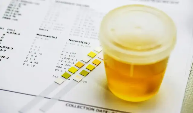 Ile moczu do badania dziecka? Kluczowe informacje i porady