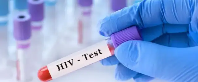 Ile kosztuje test na HIV w laboratorium? Ceny w różnych miastach