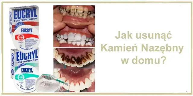 Domowy kamień nazębny: Co działa, a co szkodzi? Sprawdź!