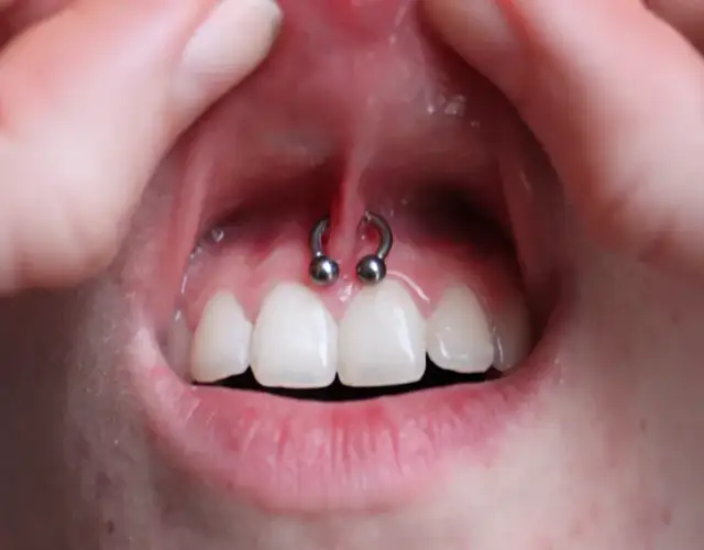 Jaki rozmiar kolczyka do smiley? Bezpieczny wybór i ryzyka