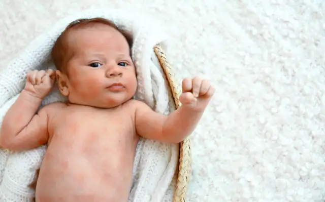 Nowe mleko modyfikowane nie pomogło, wciąż widać zaczerwienienia. Maluch w koszyku.