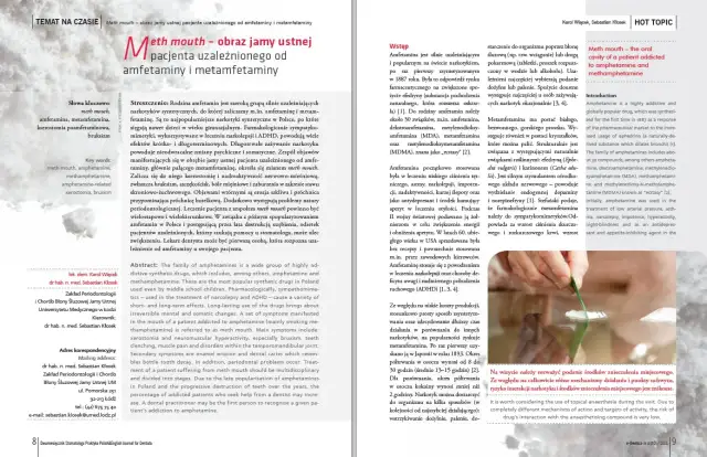 Amfetamina a zęby: Jak rozpoznać i leczyć "meth mouth"?