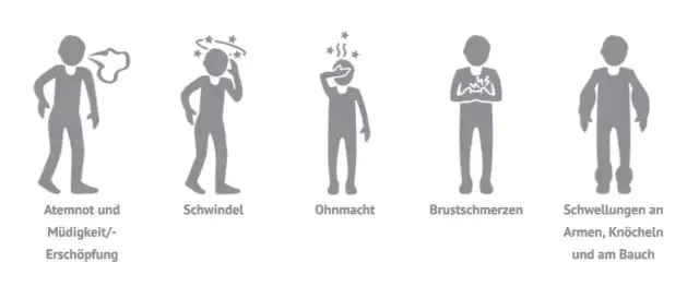 Symptome Lungenhochdruck: Warnzeichen, die Sie nicht ignorieren sollten