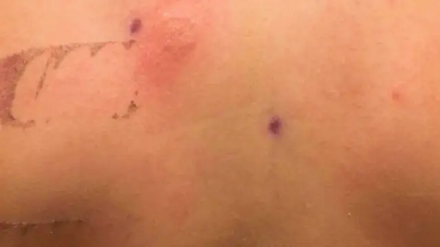 Jak rozpoznać nikiel w kosmetykach i uniknąć alergii – oznaczenia INCI